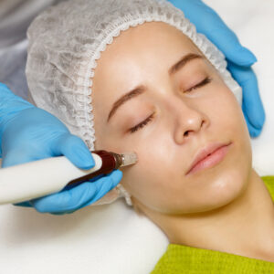 Hardware cosmetology. Mesotherapy. Dermapen. Treatment of cheek zone. Spa treatments. Face rejuvenation.